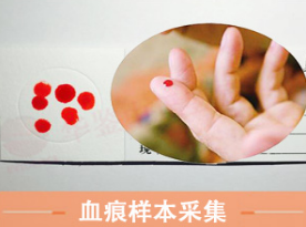 亲子鉴定检测